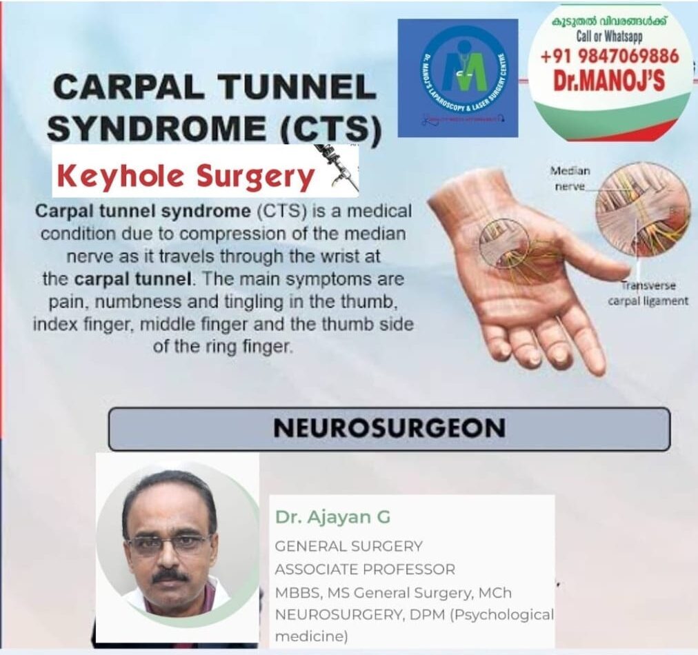Carpal tunnel syndrome keyhole surgery awareness poster featuring Dr. Ajayan G